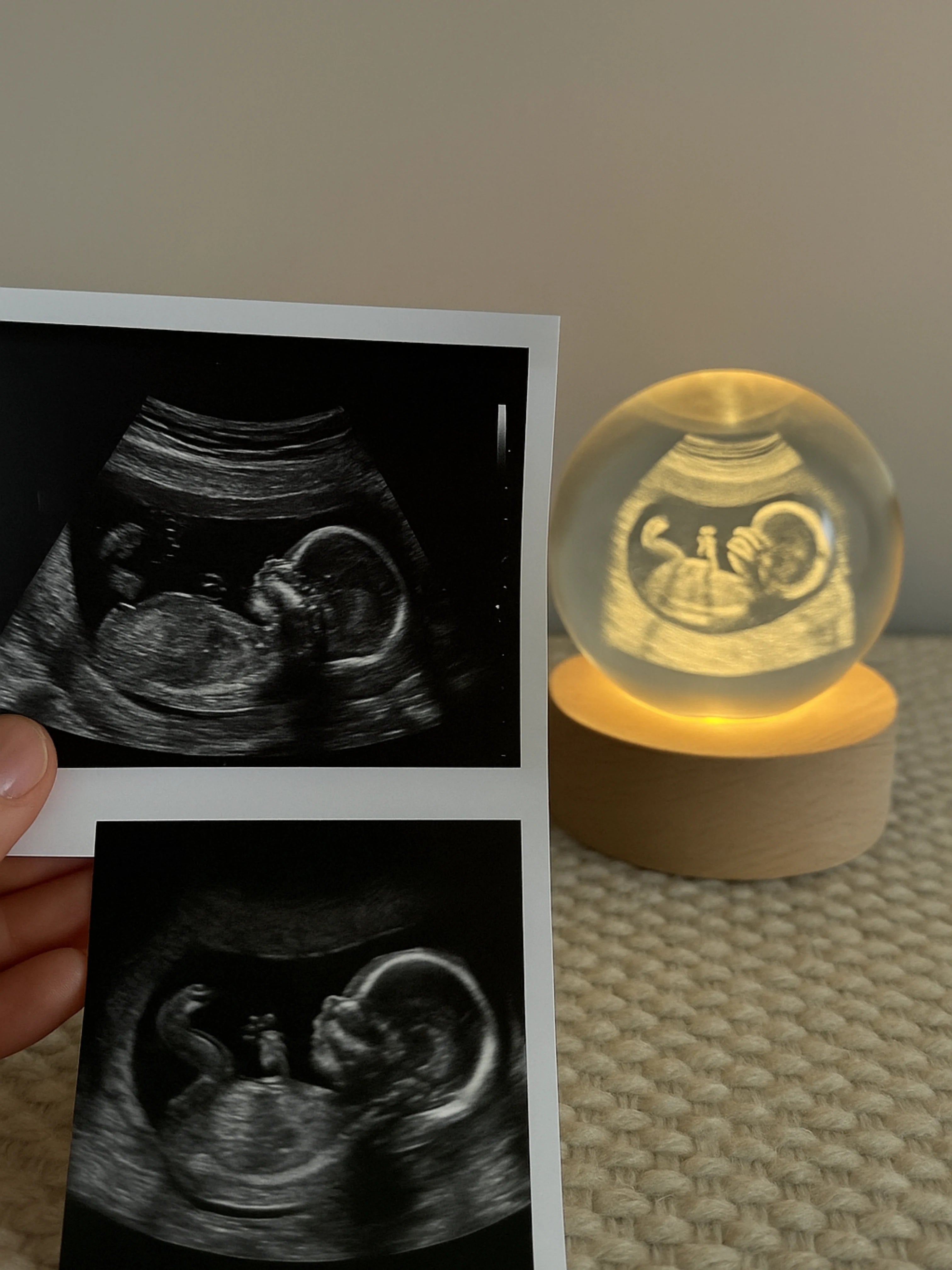 Immortalisez Votre Première Rencontre avec Votre Bébé pour Toujours
